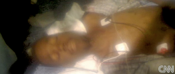 Doctors: Haitian may have survived 4 weeks in rubble