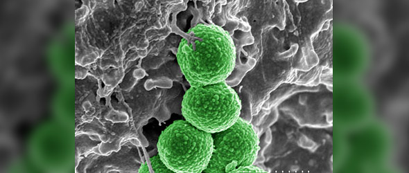 ‘Superbug’ Hits U.S. Hospitals (VIDEO)